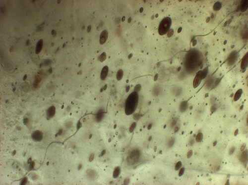 world's Oldest Spiderweb Found in Amber 2